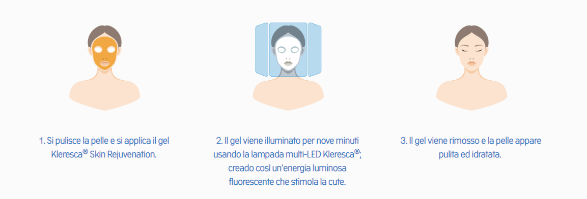 Dettagli su Kleresca